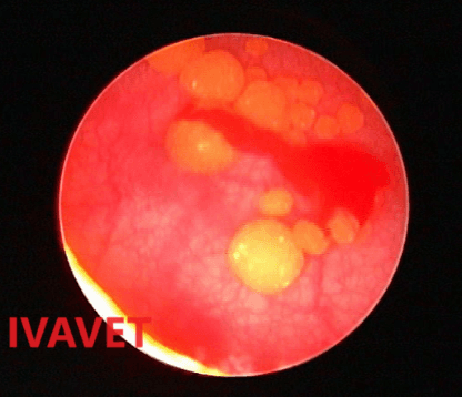 Struvitni uroliti