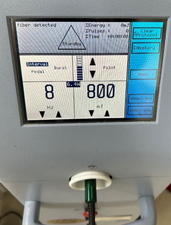 Podešavanje Holmium lasera